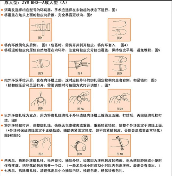 最新割包皮技术全解析：从传统方法到微创手术的革新之路