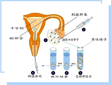 解码最新不孕技术：突破性进展、挑战与未来展望
