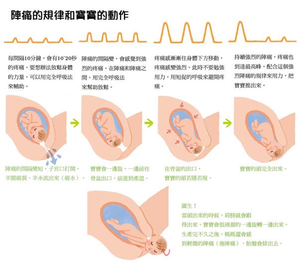 镇痛分娩最新进展：技术革新、风险评估与未来展望