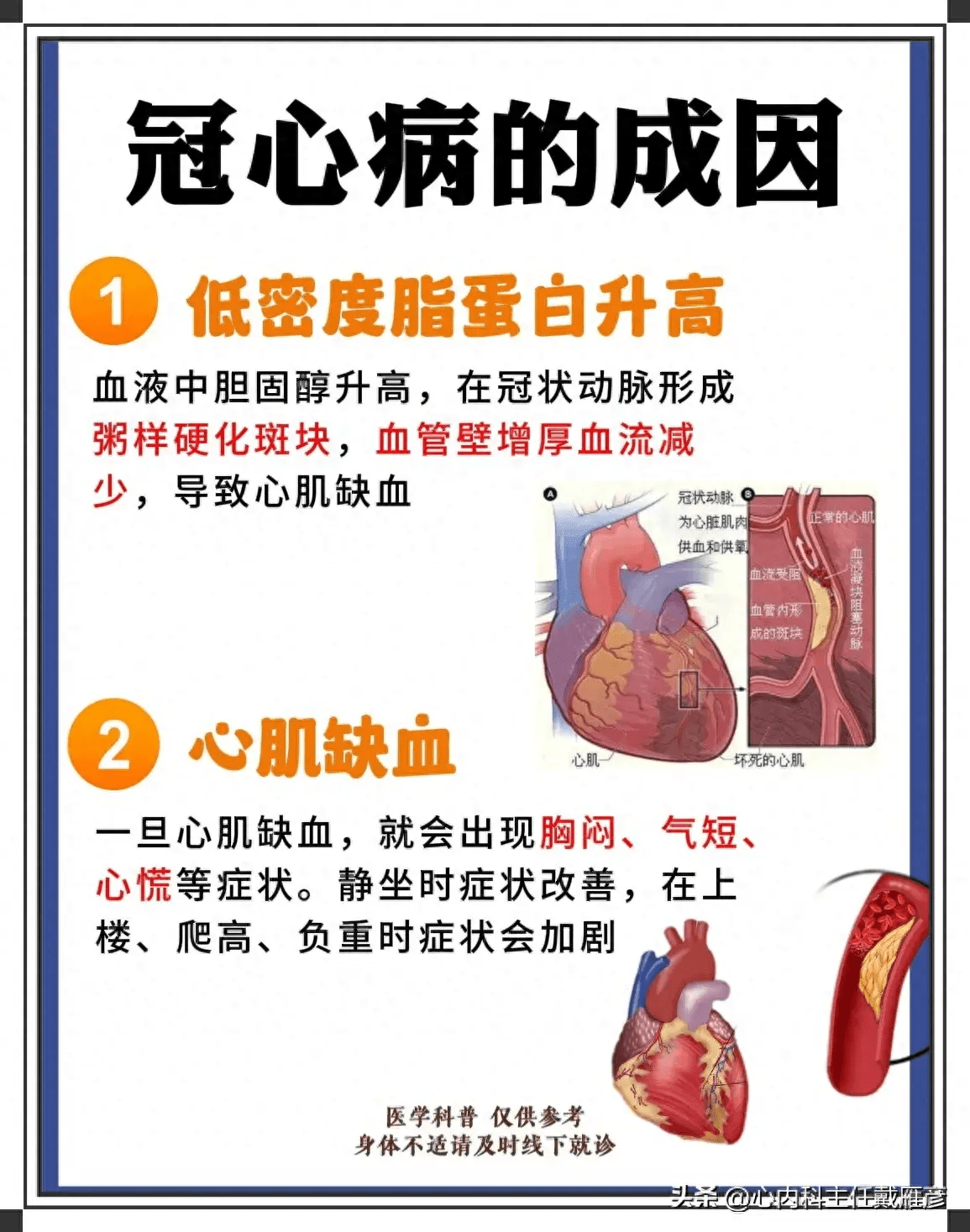 冠心病读最新：防治策略、最新研究及未来展望