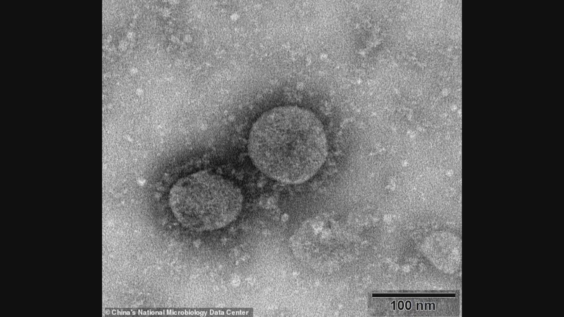 新惯病毒最新数据深度解析：传播途径、感染症状及防控策略