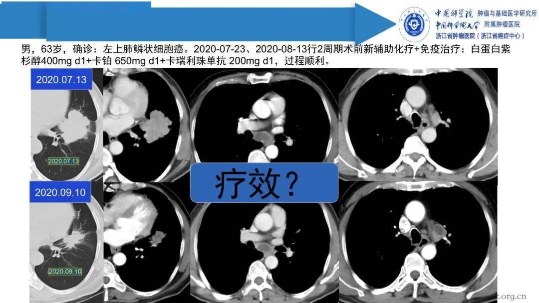 疫情中医最新进展：方药应用、临床实践及未来展望